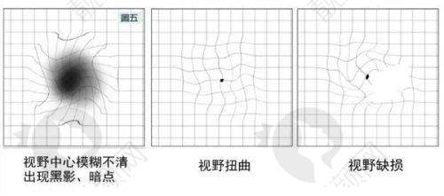 四、山西临汾洛基眼科医院基本信息：