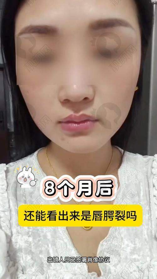 价格与术后惊喜