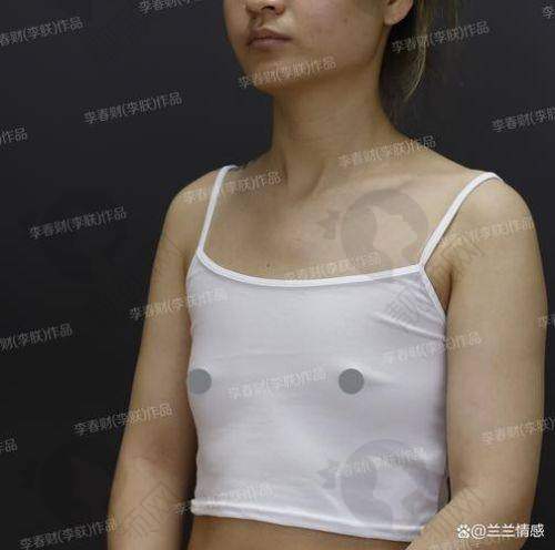脂肪填充胸成效能维持多久？术后优势之塑形减肥一举两得