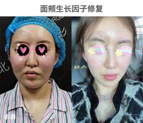 湛江韩美：规模大环境好，硬件设备齐全