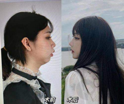 晋江市医院整形外科怎么样？地址及其他信息