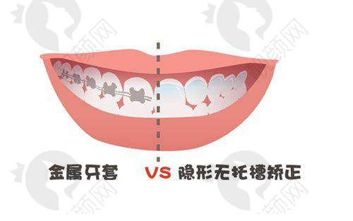王颖怎么预约？
