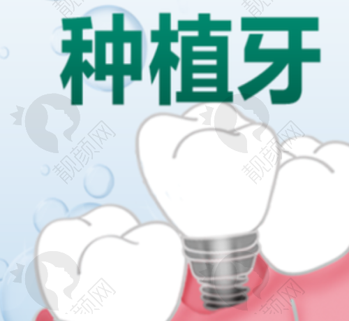 玉林医大口腔医院韩系种植牙具体优势