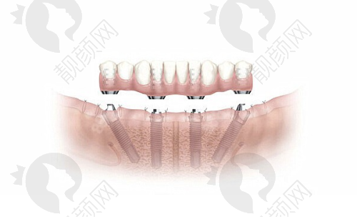 新沈阳国民口腔:正规连锁超方便