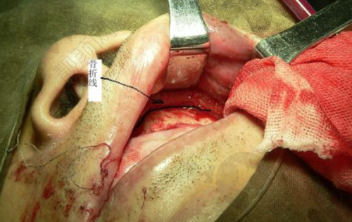 新沈阳国民口腔种植牙价格表：报价 988 起，技术先进口碑好，地址电话一键获取！