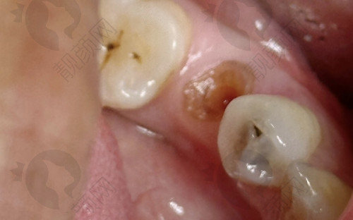 新沈阳国民口腔种植牙:技术精良没话说