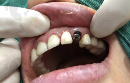 新沈阳国民口腔:地址电话一键获取