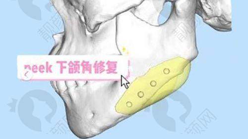 七、大理伊美东方丽人整形医院怎么预约：