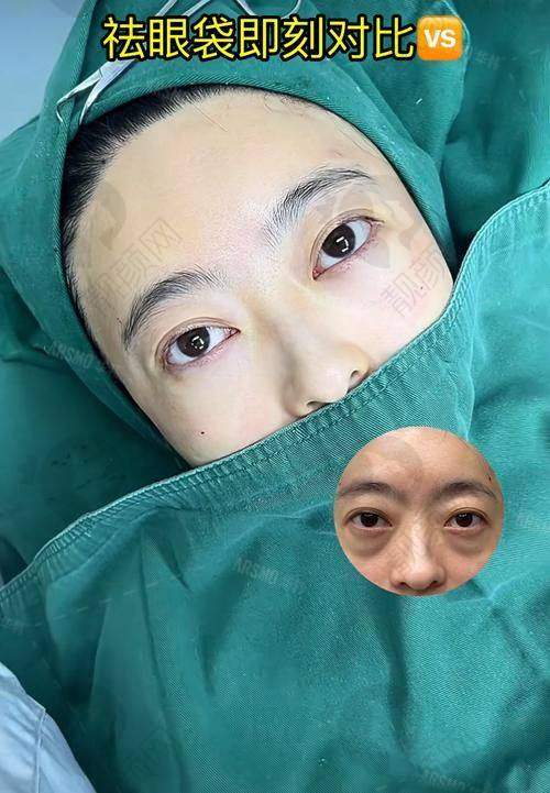 七、北京轻美颜（眼袋提升）医疗美容诊所真实的患者评价如下：