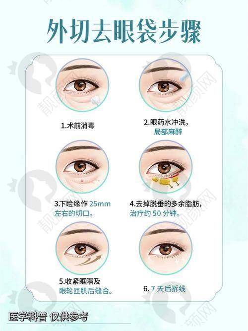 一、北京轻美颜（眼袋提升）医疗美容诊所怎么样？