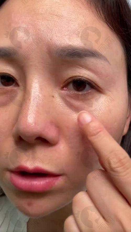 二、北京轻美颜（眼袋提升）医疗美容诊所正规吗？来看看医院资质：