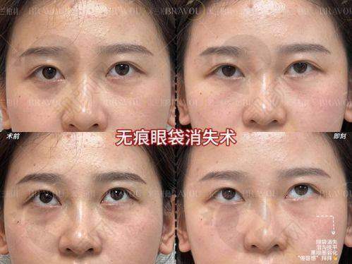 四、北京轻美颜（眼袋提升）医疗美容诊所基本信息：