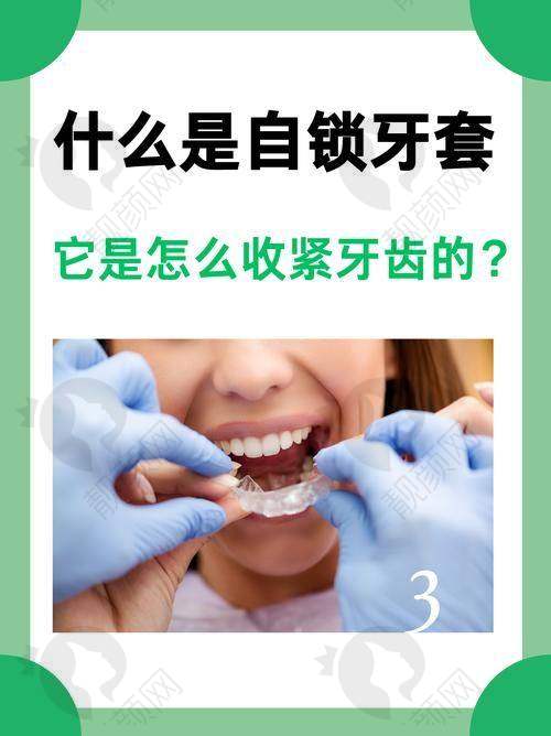 刘可乐医生正雅隐形矫正实例