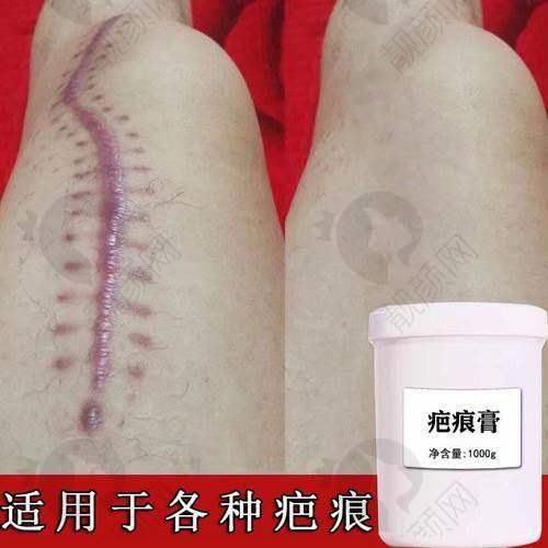 三、昆明昆大疤痕医院医生介绍: