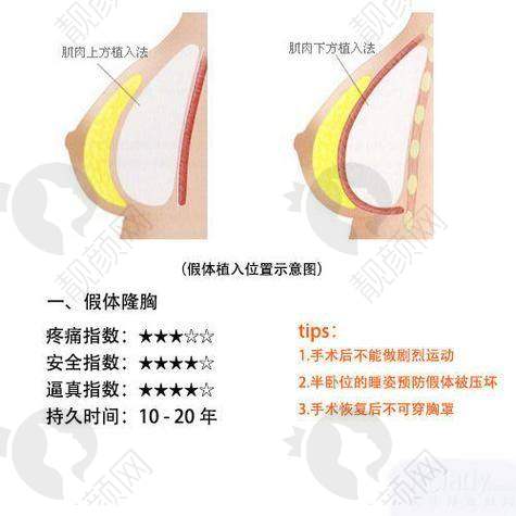 术前纠结与选择