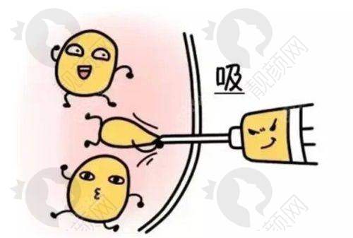 深圳曹孟君医疗美容门诊部：排名前位的吸脂实力派