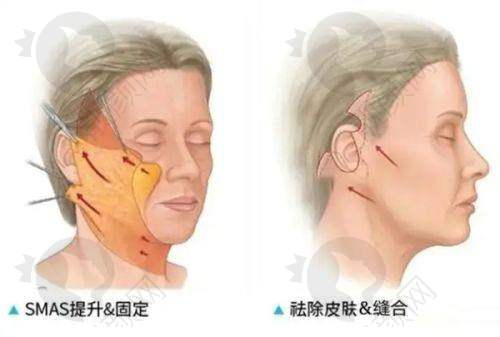 南阳第一人民医院医疗美容科：口碑超赞，患者信赖
