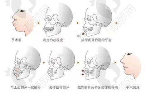 仙桃忆美医疗美容：个性化双眼皮定制骨干医生