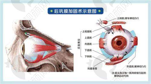 苏州光明眼科医院的价格优势