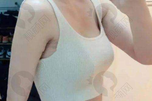 广州中家医家庭医生整形美容巨乳缩小项目优势