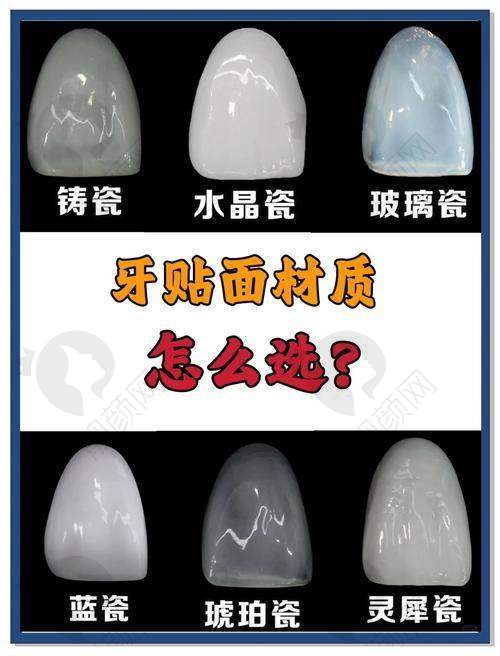 美加牙贴面与Max瓷贴面谁磨牙更少？——使用年限与磨牙关系