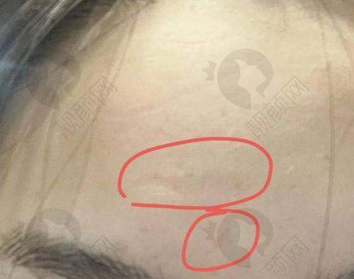 遇见深圳鹏程医院汪海军 医生