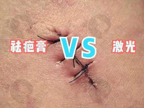 我的疤痕困扰