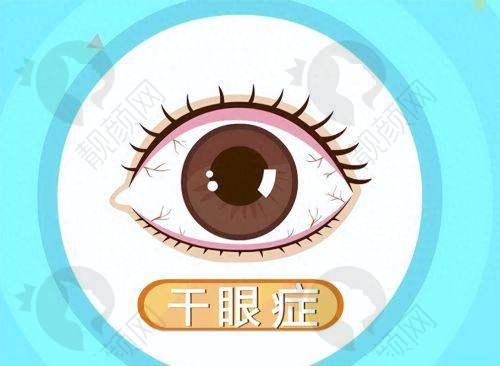 霰粒肿一年多微痛无肿，先了解它是啥