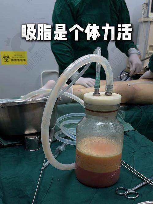 深圳美莱医疗美容医院：大型连锁的吸脂优质之选