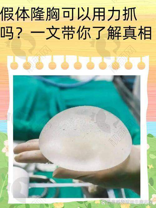穆大力隆胸成功实例