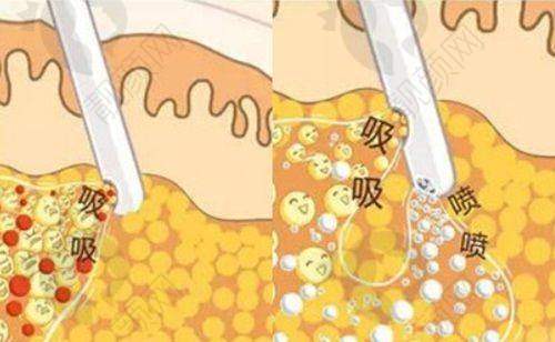 罗明生怎么预约？
