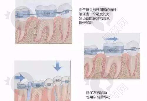 八大处张海明锚定拉皮技术优势