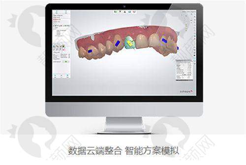 合肥中诺口腔医院电话预约超便捷，省时省力又省心