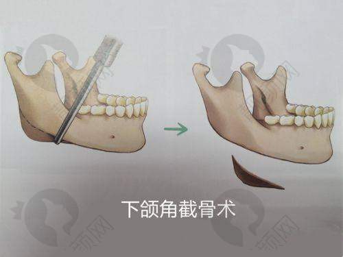 七、深圳春天阳光整形医院怎么预约：