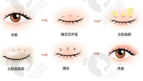 武汉五洲整形外科医院怎么去和预约?——地址明确,预约方便