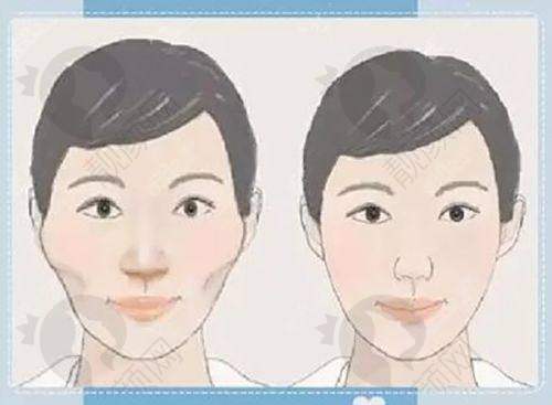 如何选择佳木斯韩艺来医疗美容医院整形项目？——知晓项目价格