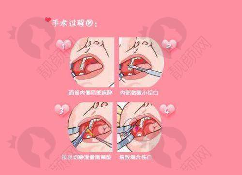 南充艾迪医疗美容：口唇整形佼佼者