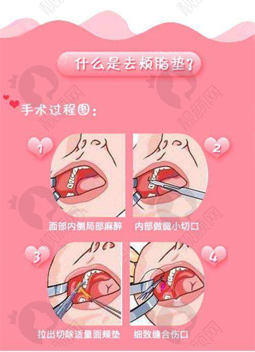 一、广州中家医家庭整形医院怎么样？