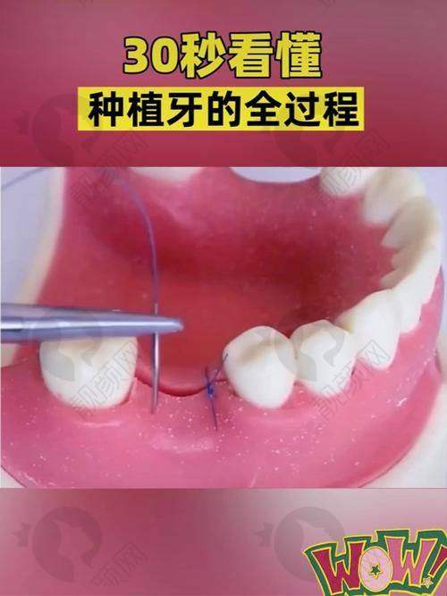 合肥中诺口腔医院服务多样，满足不同需求