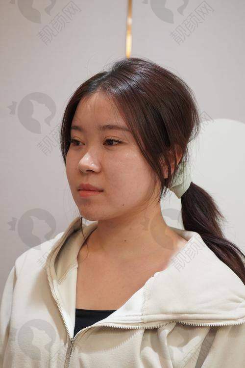 江苏淮安童颜焕美医疗王景峰医生介绍