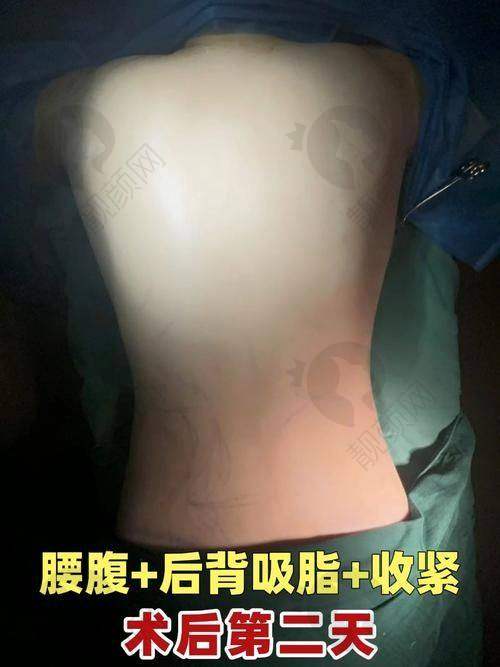 罗明生在哪家医院