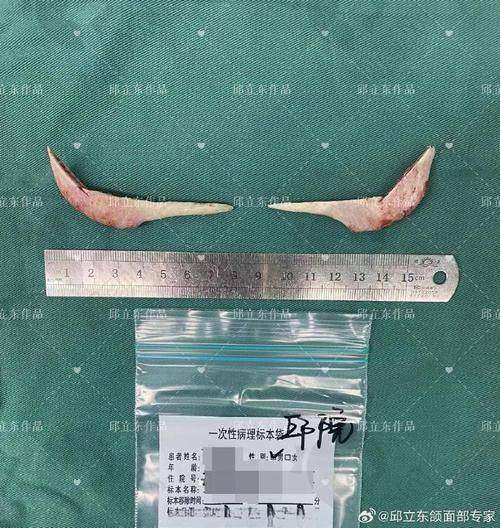 安可忍项目价格表参考