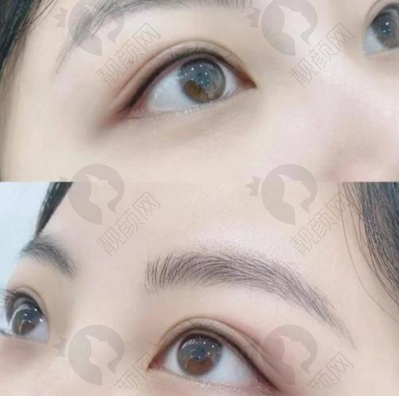 三、西安壹加壹医疗美容医院价格表：（仅供参考）