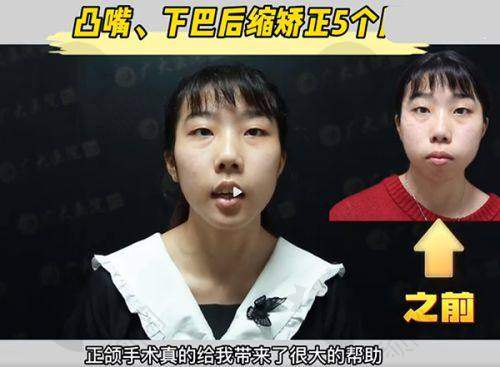 一、深圳名丽医疗美容医院怎么样？