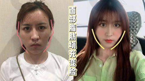 韦元强怎么预约？