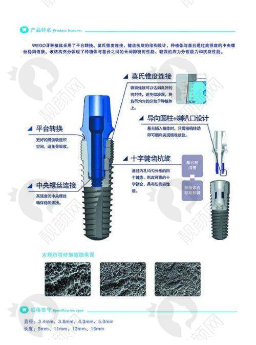 广州广大口腔种牙价格怎么样？