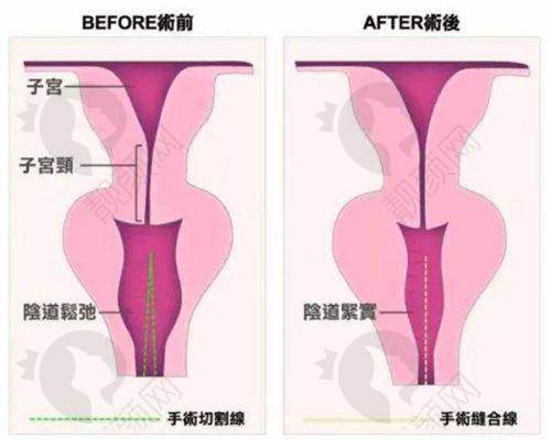七、淮安千漾美医疗美容门诊部怎么预约：