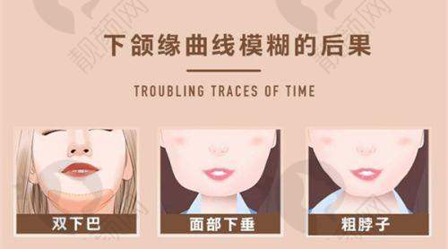 一、南京艺星医美医院怎么样？