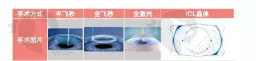 无锡华厦眼科医院医生团队