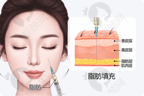 韦元强项目价格表参考